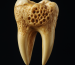 tooth-image